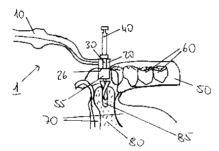 A single figure which represents the drawing illustrating the invention.